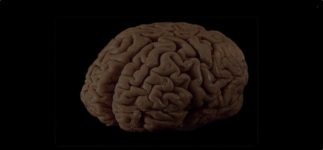 Brain image - G8 Dementia Summit 2013 declaration